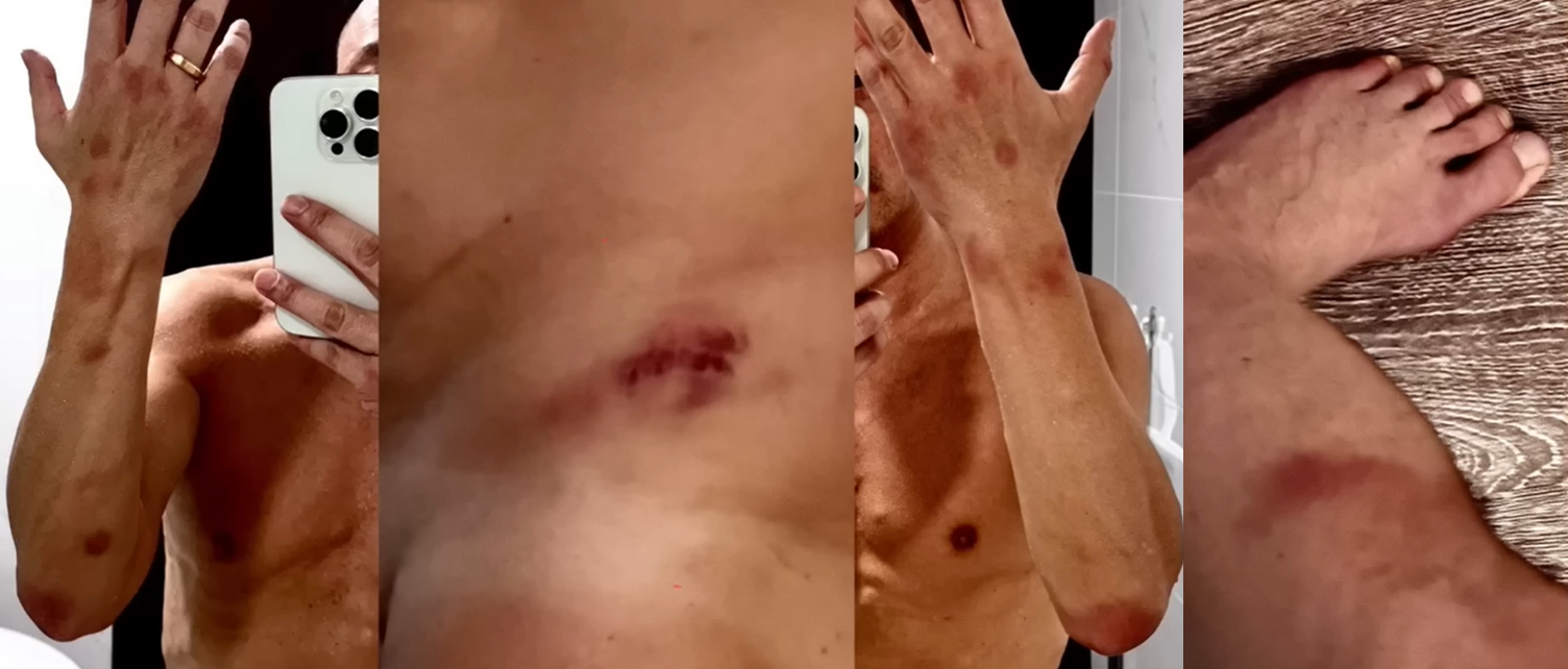 'I found blood all over my body': Hong Kong former actor Wong He reveals being sexually assaulted twice in 2024