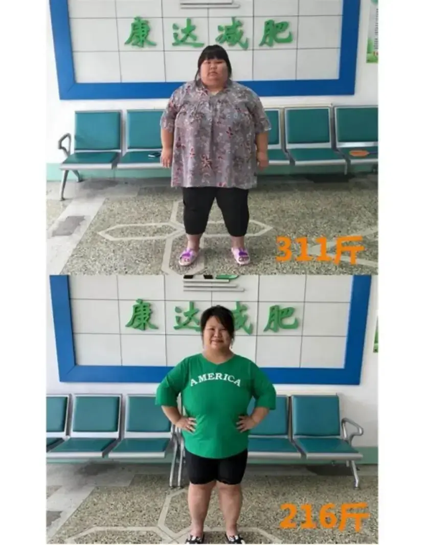 安徽校花陈皖枝：被丈夫喂到330斤，睡塌两张床，丈夫：我就喜欢你这个样子！