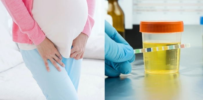 8 Causes of Dark Yellow Urine During Pregnancy, Is This Condition Dangerous?