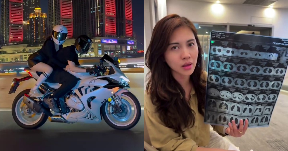 'A lesson learnt': Singapore-based woman fractures rib while attempting viral Chongqing motorcycle trend
