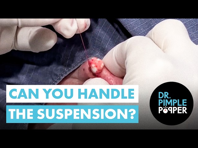 Can You Handle the Suspension?